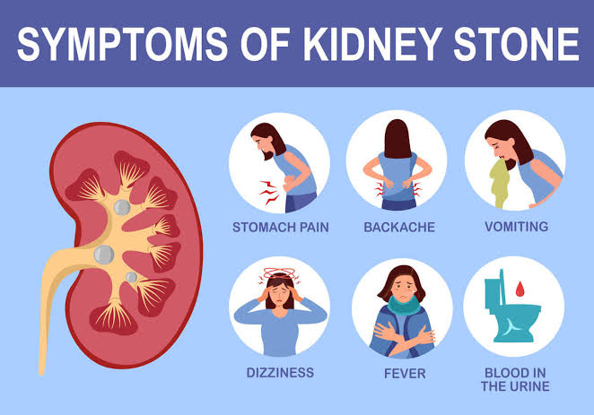 Kidney stones किडनी