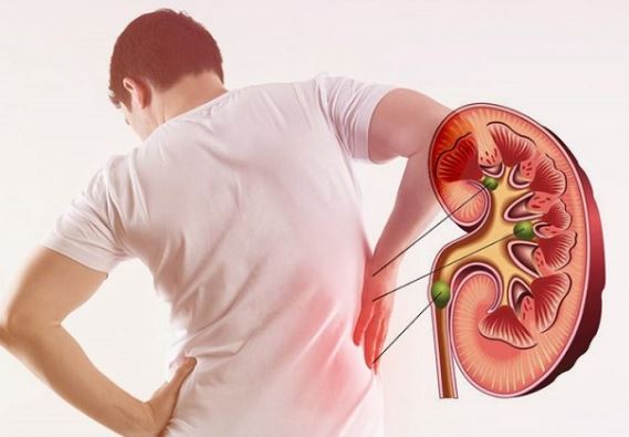 Precautions to be taken to prevent kidney damage