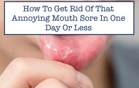 Mouth Sore/ulcer