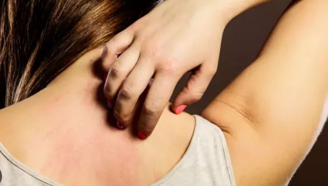 Main Causes of Itchy Body