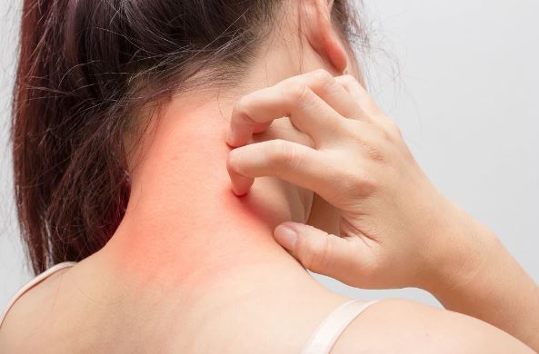 5 Main Causes of Itchy Body