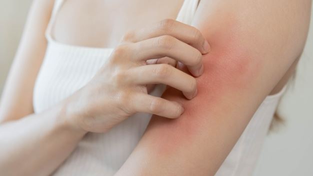 Main Causes of Itchy Body