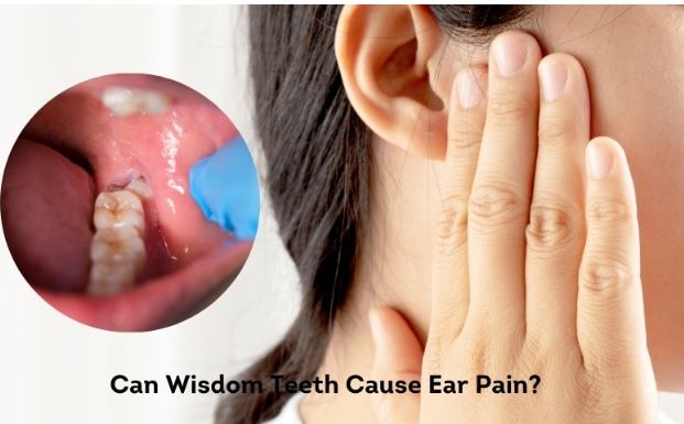 Wisdom Teeth /अक्कल दाढ/अक्ल दाढ़ें