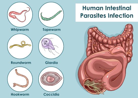 9 Symptoms of Stomach Worms