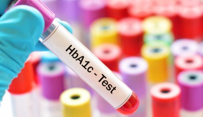 HbA1C Diabetes Control