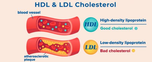 HDL High Density Lipoprotein